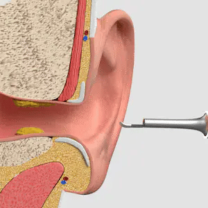 HD Ear Cleaning Tool